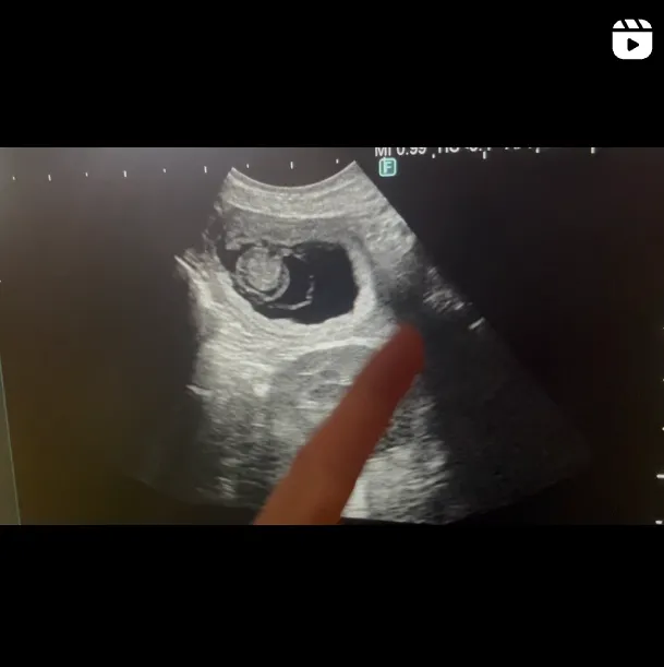 インスタグラムイメージ